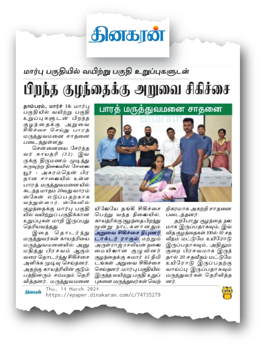 Dr. Raghul Maniam - Emergency Newborn CDH Repair in Dinakaran Tamil Daily Dr. Raghul Maniam neonatal surgeon news report in Dinakaran: Emergency Congenital Diaphragmatic Hernia CDH surgery in 3-day-old newborn at Bharath Hospital Chennai
