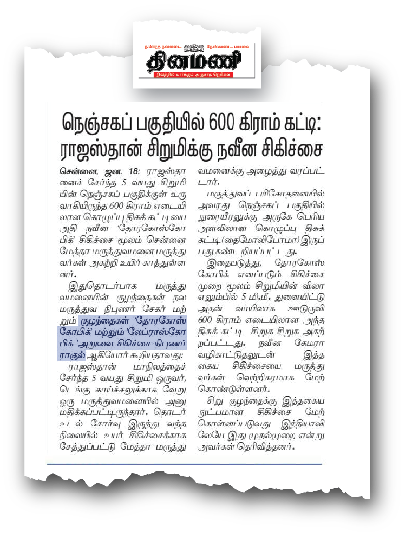 Dr. Raghul Maniam in Dinamani Tamil Daily: 5mm keyhole surgery removes 600g chest tumor in child at Dr. Mehta’s Hospital Chennai
