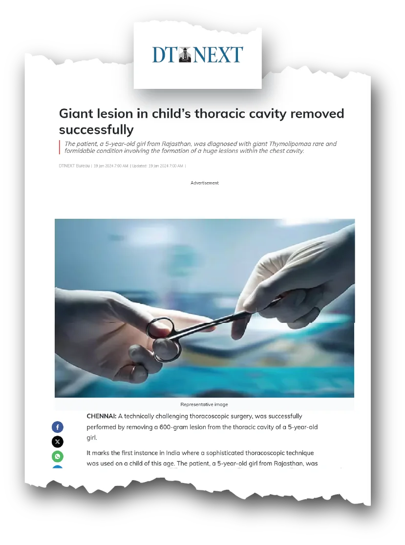 Dr. Raghul Maniam - 600g Giant Chest Lesion via 5mm VATS (DT Next) Dr. Raghul Maniam pediatric surgeon featured in DT Next news: 600g Giant Chest Lesion removed via 5mm VATS keyhole surgery at Dr. Mehta’s Children’s Hospital Chennai