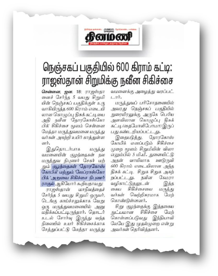 Dr. Raghul Maniam in Tamil Medical Press: Advanced pediatric laparoscopy clinical advances in neonatal emergencies at Amrit Medical Centre