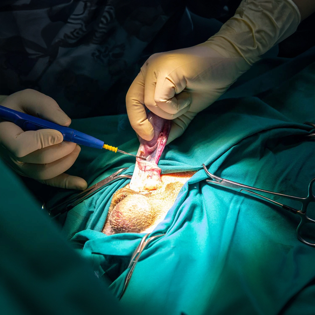 Paediatric Laparoscopy & Thoracoscopy – Dr. Raghul